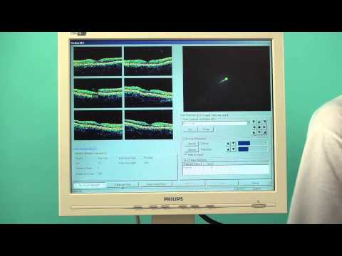 OCT Stratus V. 7.0 demonstration