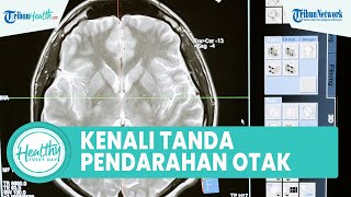 Tanda Pendarahan Otak akibat Kecelakaan yang Perlu Diwaspadai, Nyeri Otot Bagian Leher dan Bahu