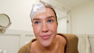 My Surgery..
