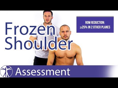 How to diagnose Frozen Shoulder | Frozen Shoulder