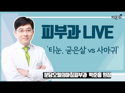 [피부과 LIVE] ‘티눈, 굳은살 vs 사마귀’ (분당오월의아침피부과의원 박준홍 원장)
