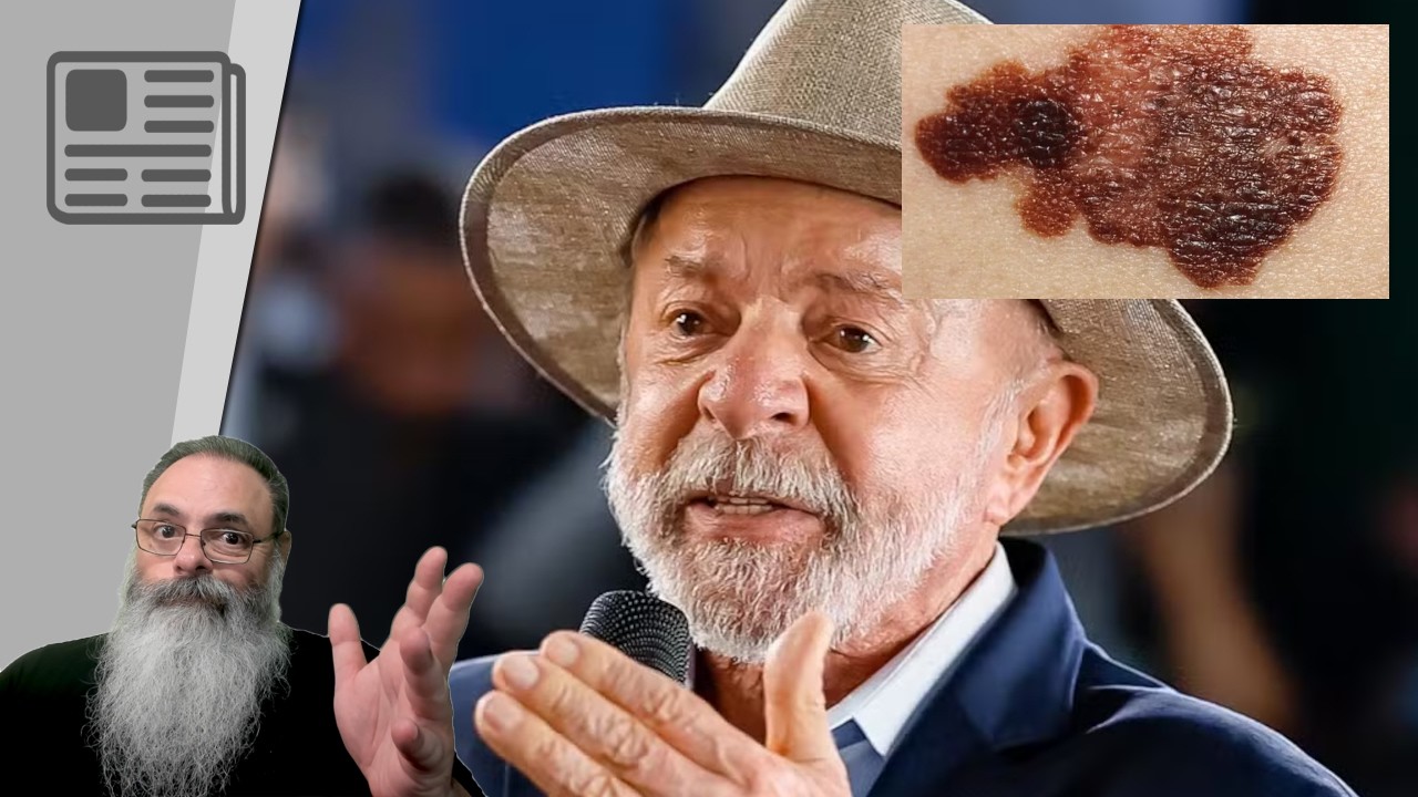 LULA faz RADIOTERAPIA contra CÂNCER: TODO mundo NA TORCIDA!