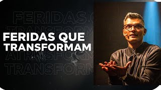 Tiago Brunet  Feridas que transformam