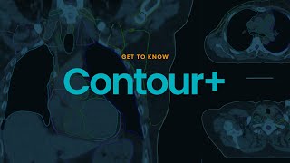 Contour+: AI Auto-Contouring for Faster, Consistent Radiotherapy Planning