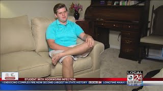 Local 24 Exclusive: Teen Diagnosed With Hookworm Shares Story of Recovery