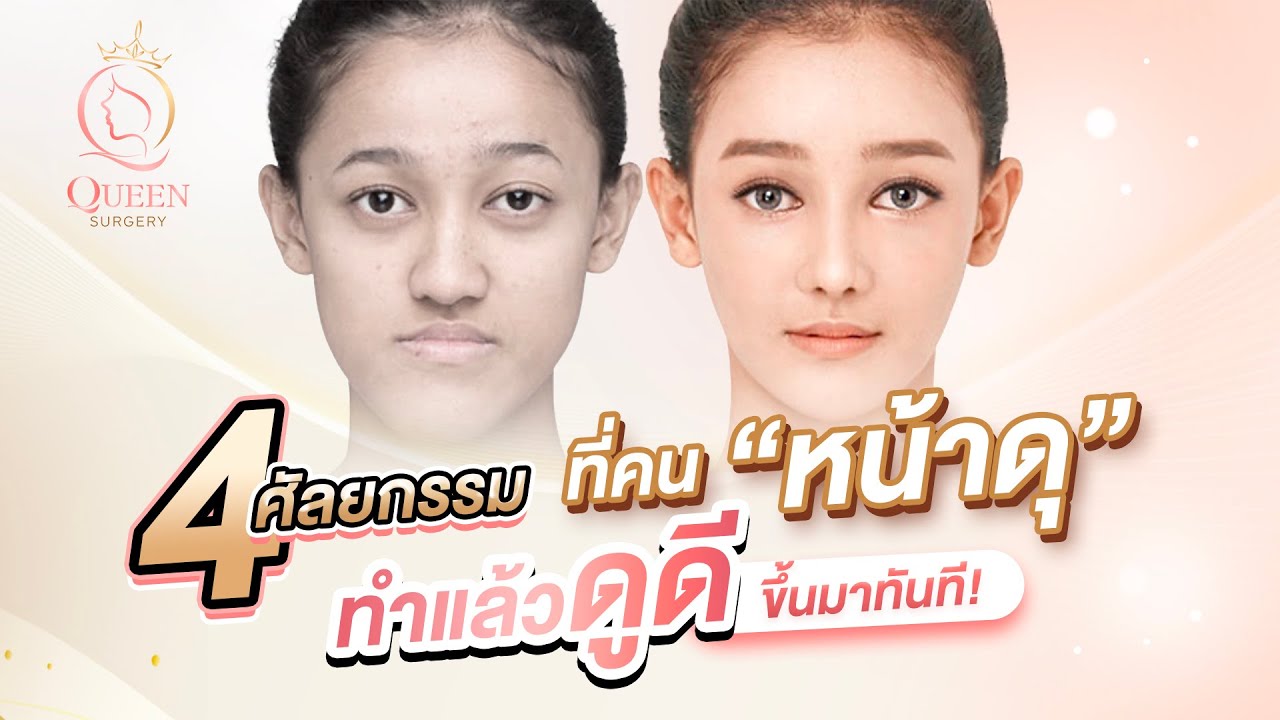 4 ศัลยกรรมที่เปลี่ยนใบหน้าดุๆ ให้ดูน่ารักและเป็นมิตรมากขึ้นได้ทันที!