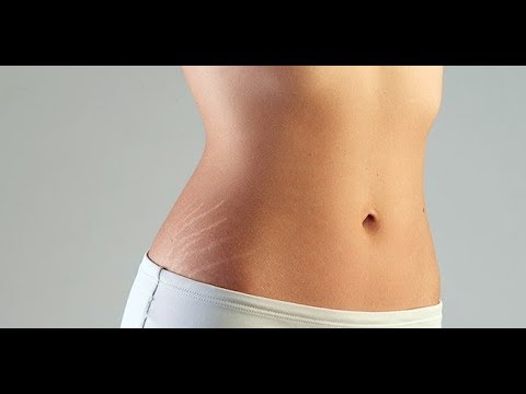 Minyak wijen untuk ulasan penurunan berat badan Ulasan pelangsing paha