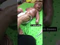 Pijat ILU Atasi Bayi Perut Kembung Dan Sembelit