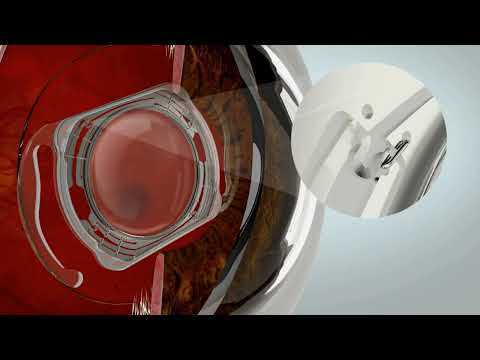 Nir Israeli, EyeMed Technologies - Adjustable cataract surgery lens for surgeons | LSI USA '26