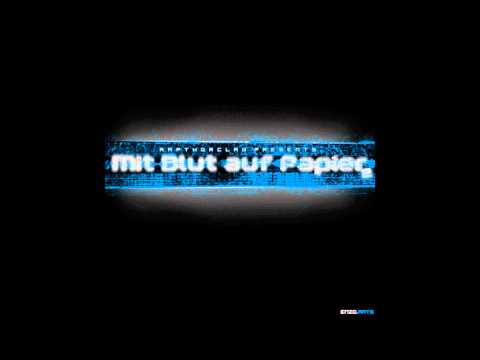 14 Hassliebe (feat. Kizmo)