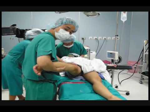 Preoperative Trauma Anterior Cruciate Ligament Test (Pivot Shift Examination)