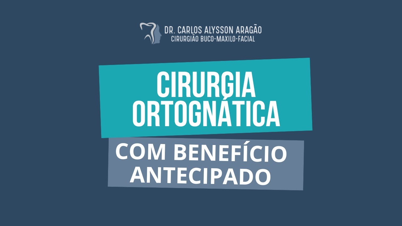 Carlos Alysson Aragão-46