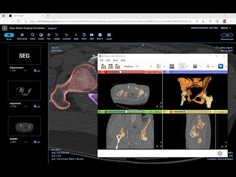 python dicom server python dicom server