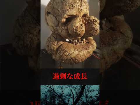 プロテウス症候群