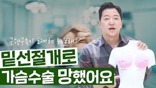 재수술상담; 밑선절개를 했는데도 구형구축이? ????