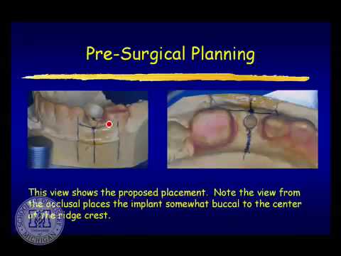 Combination Cases: Complete and Partial Denture Sets