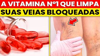 Conheça AGORA a VITAMINA poderosa que DERRETE os COÁGULOS nas pernas!