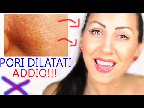 Su una faccia per comprare la crema per eliminazione di pigmentary nota in una farmacia Come mettere lunguento di zinco a una faccia da posti di pigmentary