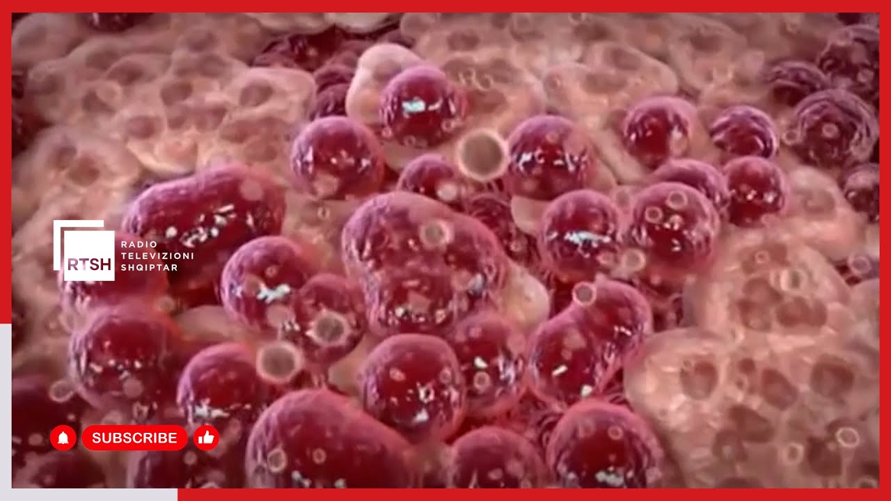 Vaksina kundër HPV-së edhe për djemtë – 422 vajza të vaksinuara në tri vite në Gjirokastër