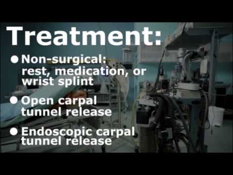Carpal Tunnel Syndrome - Open Release Surgery