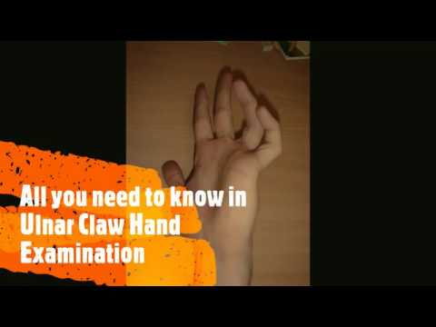 Clinical Examination Ulnar Claw hand  (High and Low Ulnar Nerve palsy) FCPS/ MS