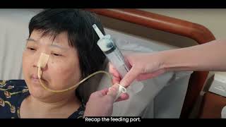 3. Performing Nasogastric Tube (NGT) Feeding