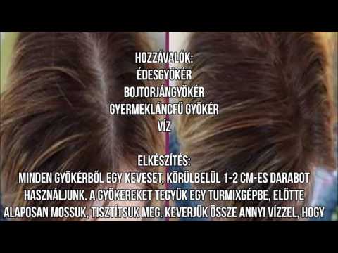 a helminthiasis kezeli iker parazita feje