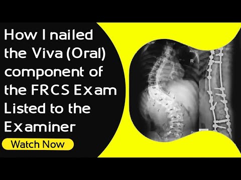 Tips & Tricks for the Viva(Oral) Component of the FRCS Exam