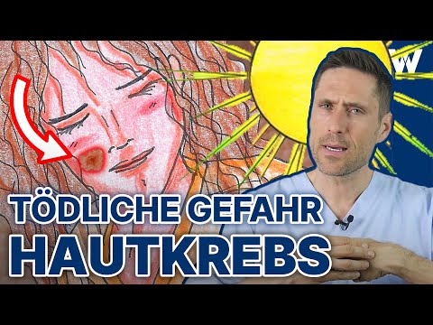 Weißer und schwarzer Hautkrebs: Selber schneller erkennen & sich davor schützen | Malignes Melanom