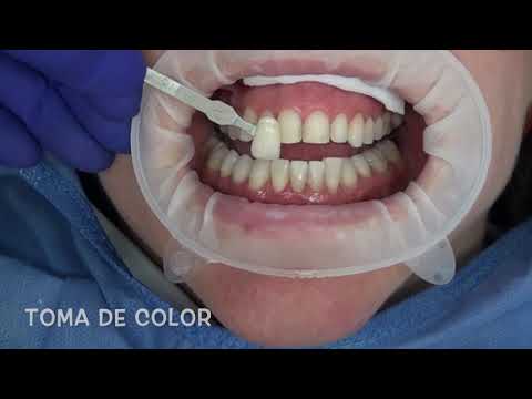 CCC-Brilliant Crios - Dr. Edgar García