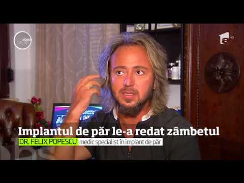 Implantul de păr le-a redat zâmbetul câtorva tineri răniţi în incendiul de la clubul Colectiv