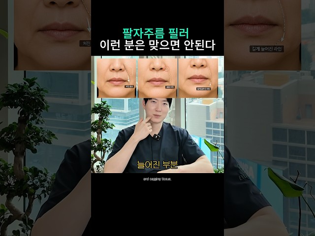 팔자필러 이런분은 하면 안된다?
