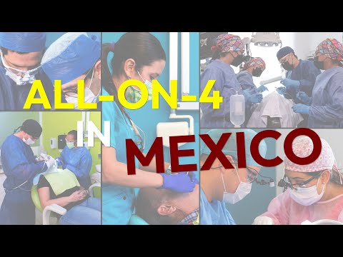 All-on-4 in Mexico