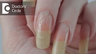 What can cause deep holes in nails & is it related to stress? - Dr. Nischal K