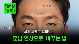 EDITION TV - 이마거상 30대 해도 될까요? 무쌍을 유지하며 이미지 변신!