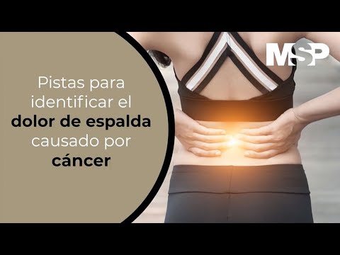 Pistas para identificar el dolor de espalda causado por cáncer