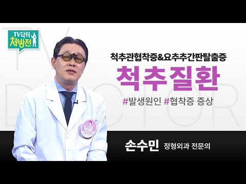 [TV닥터처방전] 척추질환 파헤치기!