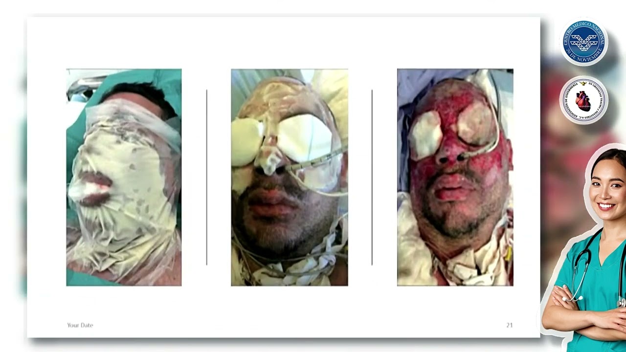 Innovación tecnológica en el paciente quemado