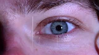 High. – “Catcher”