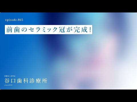 第65話 前歯のセラミック冠が完成❗️札幌駅前-赤れんがテラス-谷口歯科診療所