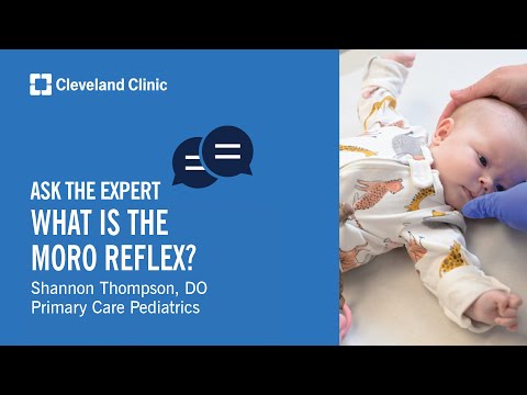 What Is the Moro Reflex? | Ask Cleveland Clinic’s Expert