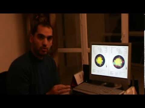 Rétinite Pigmentaire Traitement (Preuve) in FIRATLI CLINIC -French