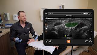 Ultrasound Guided Carpal Tunnel Injection