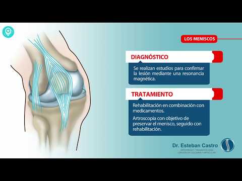 Cómo elegir el calzado ideal para proteger tus articulaciones