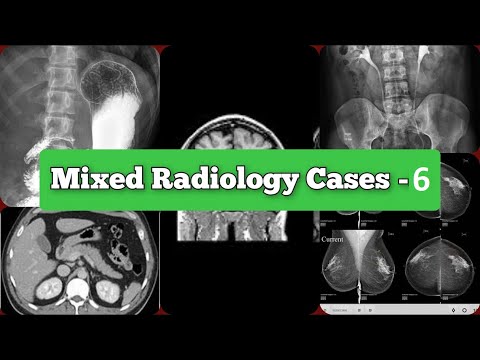 Radiology Viva Cases # 172-180 | Mixes Exam Cases | Hemangioma types and Cases #medical #radiology