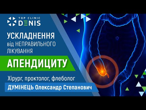 Наслідки неправильного лікування апендециту - TOP Clinic DENIS