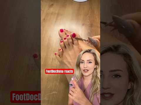 Doctor reacts: born with 12 toes?