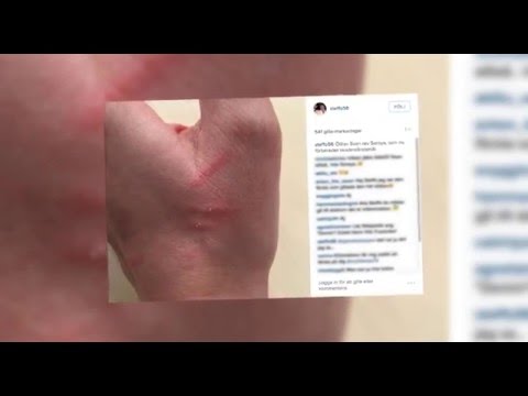 Reptilproblemet i TV4:s "Nyhetsmorgon"