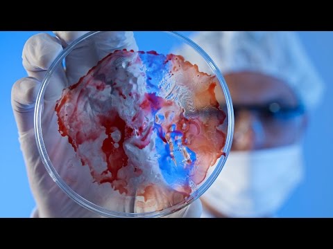 ME/Chronic Fatigue Syndrome: Not Just Tired All The Time! - Dr Alistair Miller