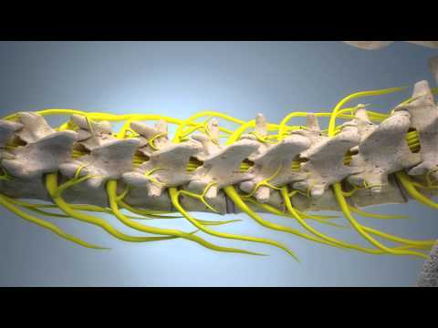 Radiofrequency Ablation (EN version)